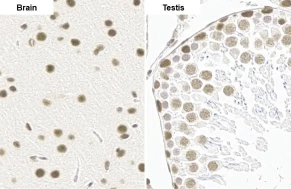 BRM Antibody (HL1115)