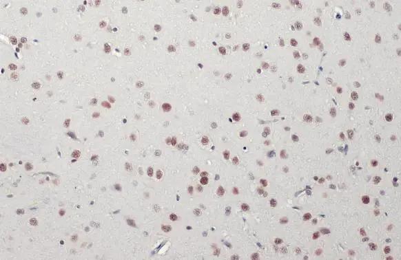BRM Antibody (HL1115) - Azide and BSA Free