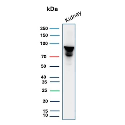 MICA Antibody (MICA/4442) Western Blot: MICA Antibody (MICA/4442) [NBP3-13826] -