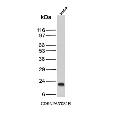 p16INK4a/CDKN2A Antibody (CDKN2A/7081R) Western Blot: p16INK4a/CDKN2A Antibody (CDKN2A/7081R) [NBP3-13834] -