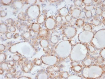 UBR2 Antibody (PCRP-UBR2-1D12)