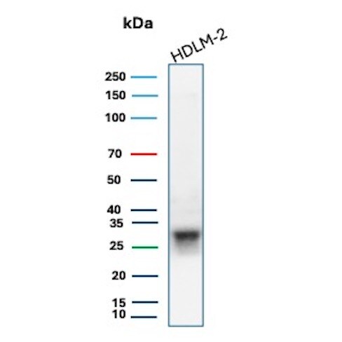 HLA DQ/DR/DP Antibody (HLA-Pan/6663) Western Blot: HLA DQ/DR/DP Antibody (HLA-Pan/6663) [NBP3-13905] -
