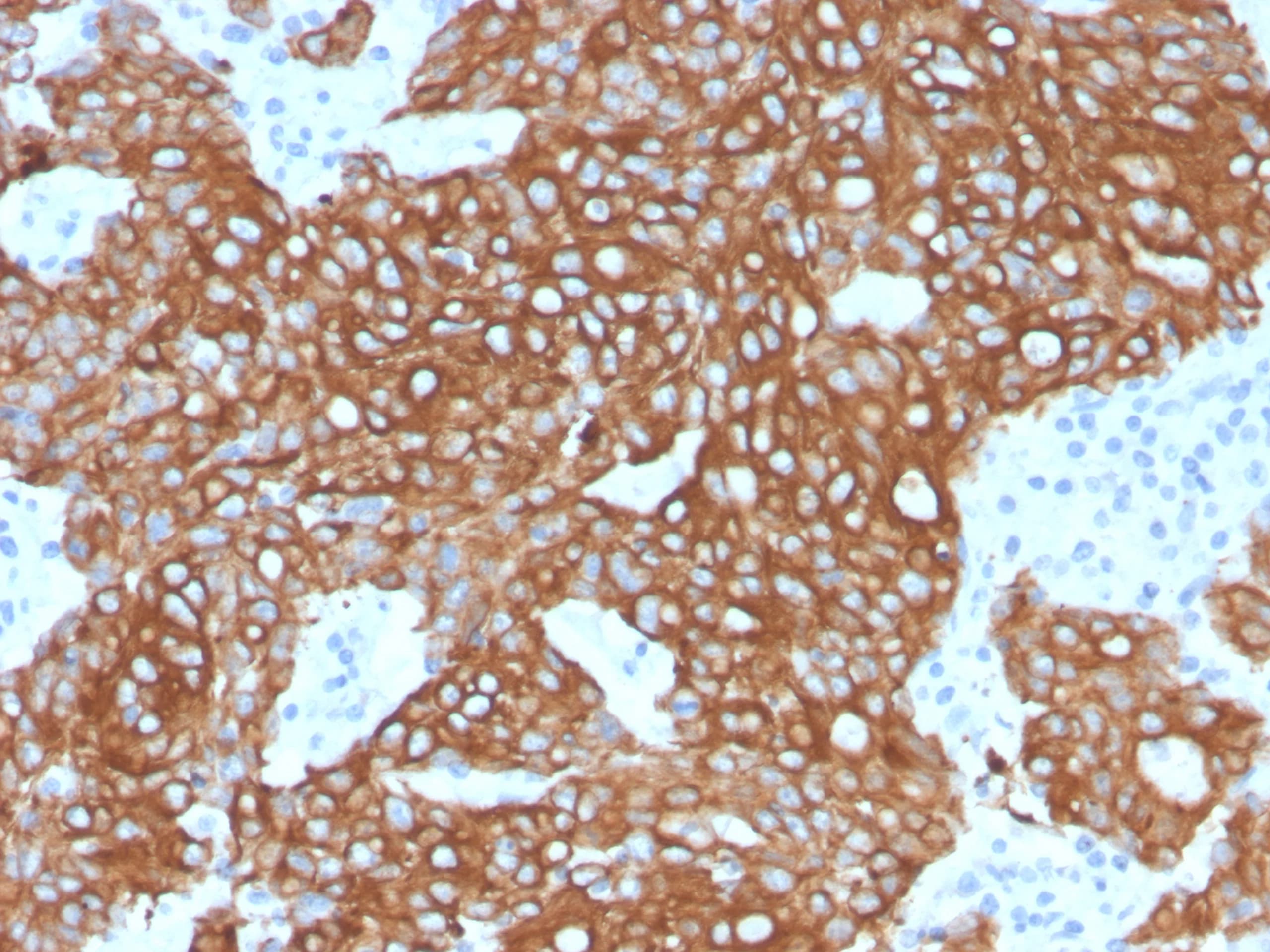 Cytokeratin 8/18 Antibody (KRT8.18/6579R) Immunohistochemistry-Paraffin: Cytokeratin 8/18 Antibody (KRT8.18/6579R) [NBP3-13911] -