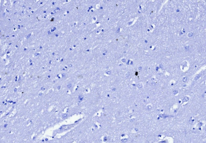 Cytokeratin 6a Antibody (KRT6/3997R)