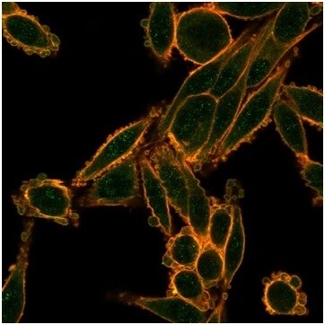 Smad9 Antibody (PCRP-SMAD9-2F4) Immunocytochemistry/ Immunofluorescence: Smad9 Antibody (PCRP-SMAD9-2F4) [NBP3-13964] -
