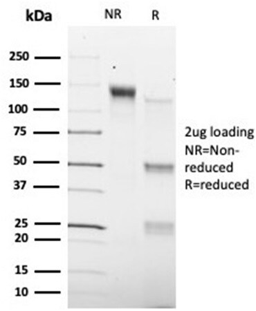 Smad9 Antibody (PCRP-SMAD9-2F4) Immunocytochemistry/ Immunofluorescence: Smad9 Antibody (PCRP-SMAD9-2F4) [NBP3-13964] -