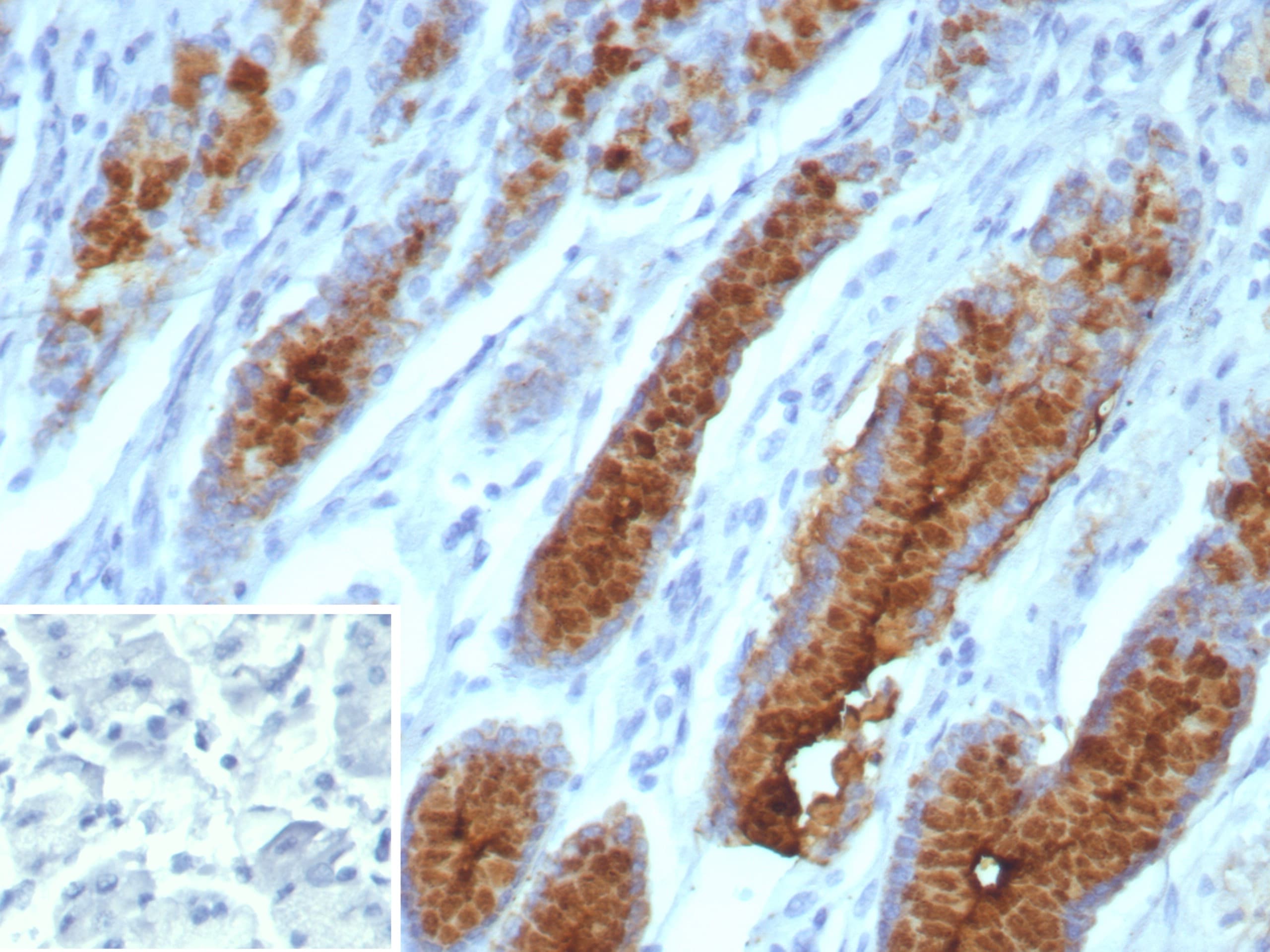 MUC5AC Antibody (MUC5AC/7066R) - Azide and BSA Free Immunohistochemistry-Paraffin: MUC5AC Antibody (MUC5AC/7066R) - Azide and BSA Free [NBP3-14003] -