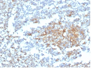 Vitamin D BP Antibody (VDBP/4482) - Azide and BSA Free