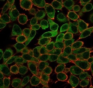 MYCL1/L-Myc Antibody (PCRP-MYCL-2D5) - Azide and BSA Free Immunocytochemistry/ Immunofluorescence: MYCL1/L-Myc Antibody (PCRP-MYCL-2D5) - Azide and BSA Free [NBP3-14011] -