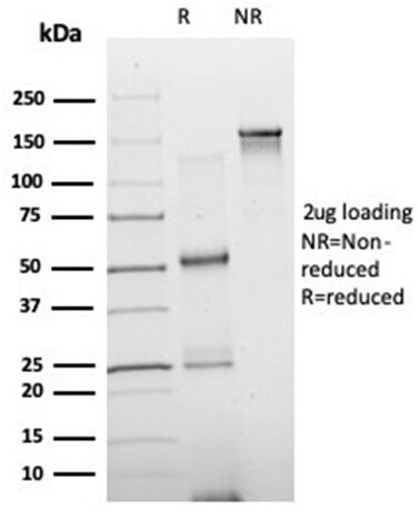 NeuroD2 Antibody (PCRP-NEUROD2-1G1) - Azide and BSA Free Immunocytochemistry/ Immunofluorescence: NeuroD2 Antibody (PCRP-NEUROD2-1G1) - Azide and BSA Free [NBP3-14015] -