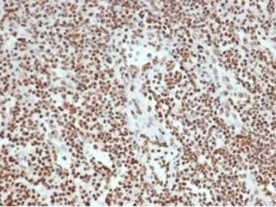 Ku80/XRCC5 Antibody (XRCC5/7315) - Azide and BSA Free Immunohistochemistry-Paraffin: Ku80/XRCC5 Antibody (XRCC5/7315) - Azide and BSA Free [NBP3-14017] -