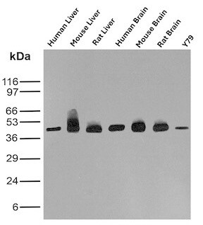 Glutamine Synthetase Antibody (GLUL/6600) - Azide and BSA Free Western Blot: Glutamine Synthetase Antibody (GLUL/6600) - Azide and BSA Free [NBP3-14023] -