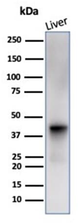 Glutamine Synthetase Antibody (GLUL/6600) - Azide and BSA Free Western Blot: Glutamine Synthetase Antibody (GLUL/6600) - Azide and BSA Free [NBP3-14023] -