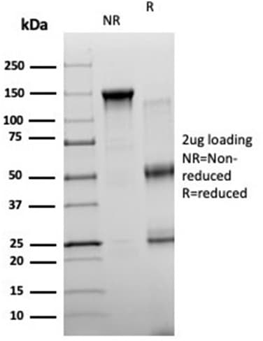 Neurogenin-3 Antibody (PCRP-NEUROG3-1E10) - Azide and BSA Free Immunocytochemistry/ Immunofluorescence: Neurogenin-3 Antibody (PCRP-NEUROG3-1E10) - Azide and BSA Free [NBP3-14029] -