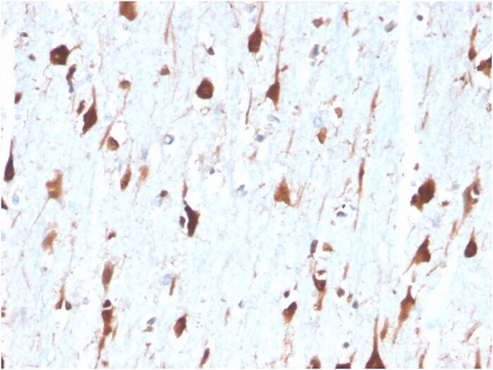 Carbonic Anhydrase VIII/CA8 Antibody (CA8/6572) - Azide and BSA Free Immunohistochemistry-Paraffin: Carbonic Anhydrase VIII/CA8 Antibody (CA8/6572) - Azide and BSA Free [NBP3-14030] -