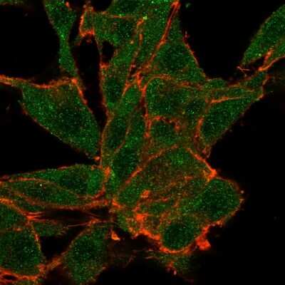 NOC4L Antibody (PCRP-NOC4L-1B2) - Azide and BSA Free Immunocytochemistry/ Immunofluorescence: NOC4L Antibody (PCRP-NOC4L-1B2) - Azide and BSA Free [NBP3-14031] -