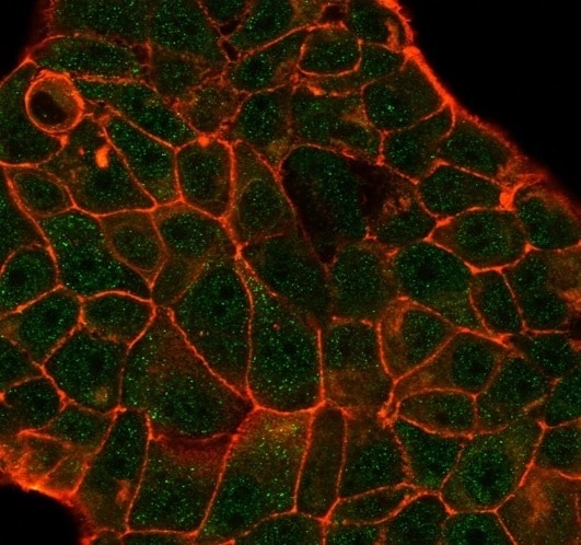 DCP2 Antibody (PCRP-DCP2-1D6) - Azide and BSA Free Immunocytochemistry/ Immunofluorescence: DCP2 Antibody (PCRP-DCP2-1D6) - Azide and BSA Free [NBP3-14037] -