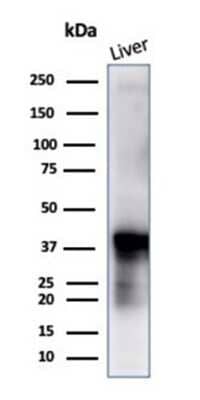 Glutamine Synthetase Antibody (GLUL/6604) - Azide and BSA Free Western Blot: Glutamine Synthetase Antibody (GLUL/6604) - Azide and BSA Free [NBP3-14039] -