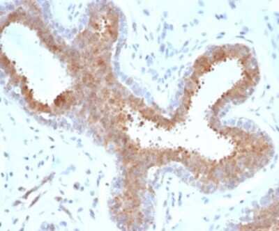 BAP1 Antibody (BAP1/6861R) - Azide and BSA Free Immunohistochemistry-Paraffin: BAP1 Antibody (BAP1/6861R) - Azide and BSA Free [NBP3-14042] -