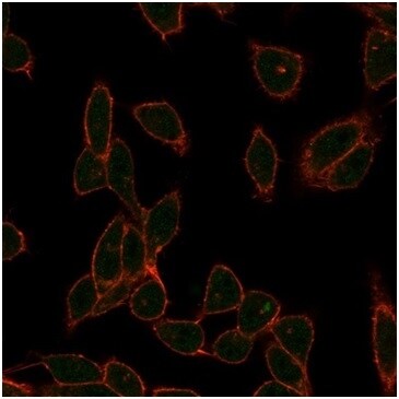 ZC3H7A Antibody (PCRP-ZC3H7A-1D6) - Azide and BSA Free Immunocytochemistry/ Immunofluorescence: ZC3H7A Antibody (PCRP-ZC3H7A-1D6) - Azide and BSA Free [NBP3-14047] -