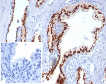 SLC45A3/Prostein Antibody (SLC45A3/7176R) - Azide and BSA Free Immunohistochemistry-Paraffin: SLC45A3/Prostein Antibody (SLC45A3/7176R) - Azide and BSA Free [NBP3-14049] -