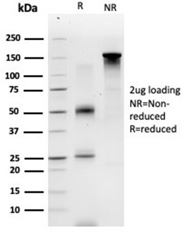 GTF2A1 Antibody (PCRP-GTF2A1-1F2) - Azide and BSA Free Immunocytochemistry/ Immunofluorescence: GTF2A1 Antibody (PCRP-GTF2A1-1F2) - Azide and BSA Free [NBP3-14054] -