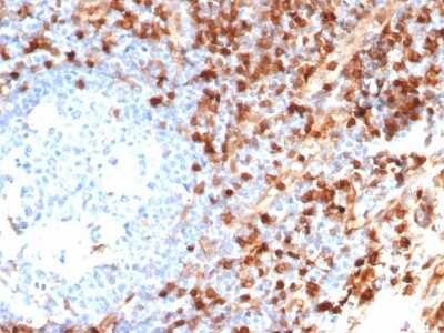 Annexin A1 Antibody (ANXA1/6452R) - Azide and BSA Free Immunohistochemistry-Paraffin: Annexin A1 Antibody (ANXA1/6452R) - Azide and BSA Free [NBP3-14056] -