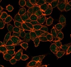 CBFB Antibody (PCRP-CBFB-1F6) - Azide and BSA Free Immunocytochemistry/ Immunofluorescence: CBFB Antibody (PCRP-CBFB-1F6) - Azide and BSA Free [NBP3-14058] -