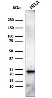 CBFB Antibody (PCRP-CBFB-1E6) - Azide and BSA Free Western Blot: CBFB Antibody (PCRP-CBFB-1E6) - Azide and BSA Free [NBP3-14059] -
