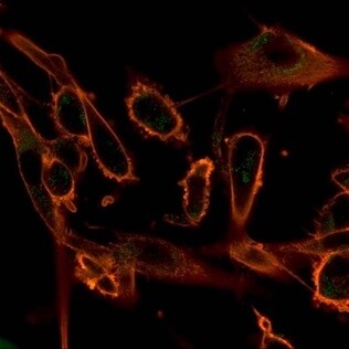 CBFB Antibody (PCRP-CBFB-1E6) - Azide and BSA Free Immunocytochemistry/ Immunofluorescence: CBFB Antibody (PCRP-CBFB-1E6) - Azide and BSA Free [NBP3-14059] -