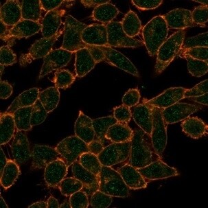 HDAC3 Antibody (PCRP-HDAC3-2D4) - Azide and BSA Free Immunocytochemistry/ Immunofluorescence: HDAC3 Antibody (PCRP-HDAC3-2D4) - Azide and BSA Free [NBP3-14060] -