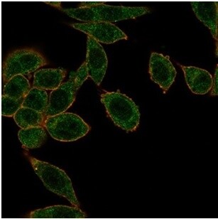 HOXB2 Antibody (PCRP-HOXB2-1F2) - Azide and BSA Free Immunocytochemistry/ Immunofluorescence: HOXB2 Antibody (PCRP-HOXB2-1F2) - Azide and BSA Free [NBP3-14063] -