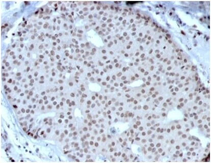 HOXB2 Antibody (PCRP-HOXB2-1F2) - Azide and BSA Free Immunohistochemistry-Paraffin: HOXB2 Antibody (PCRP-HOXB2-1F2) - Azide and BSA Free [NBP3-14063] -