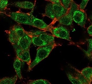 MED21 Antibody (PCRP-MED21-4B5) - Azide and BSA Free Immunocytochemistry/ Immunofluorescence: MED21 Antibody (PCRP-MED21-4B5) - Azide and BSA Free [NBP3-14069] -