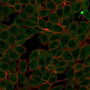MED7 Antibody (PCRP-MED7-1B8) - Azide and BSA Free Immunocytochemistry/ Immunofluorescence: MED7 Antibody (PCRP-MED7-1B8) - Azide and BSA Free [NBP3-14071] -