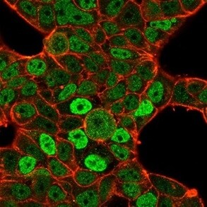 QKI/Quaking Antibody (PCRP-QKI-2F10) - Azide and BSA Free Immunocytochemistry/ Immunofluorescence: QKI/Quaking Antibody (PCRP-QKI-2F10) - Azide and BSA Free [NBP3-14072] -
