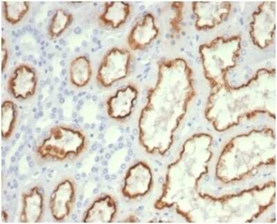 Cdc20 Antibody (CDC20/7026R) - Azide and BSA Free Immunohistochemistry-Paraffin: Cdc20 Antibody (CDC20/7026R) - Azide and BSA Free [NBP3-14078] -