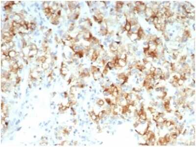 Cdc20 Antibody (CDC20/7026R) - Azide and BSA Free Immunohistochemistry-Paraffin: Cdc20 Antibody (CDC20/7026R) - Azide and BSA Free [NBP3-14078] -