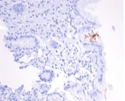 Catalase Antibody (HPYL/7170) - (H. pylori) - Azide and BSA Free Immunohistochemistry-Paraffin: Catalase Antibody (HPYL/7170) - (H. pylori) - Azide and BSA Free [NBP3-14079] -