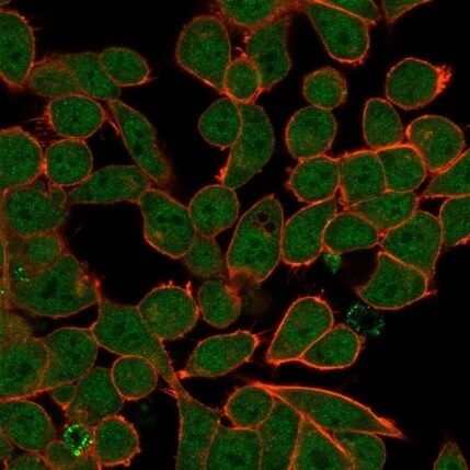 ZNF81 Antibody (PCRP-ZNF81-2C7) - Azide and BSA Free Immunocytochemistry/ Immunofluorescence: ZNF81 Antibody (PCRP-ZNF81-2C7) - Azide and BSA Free [NBP3-14081] -
