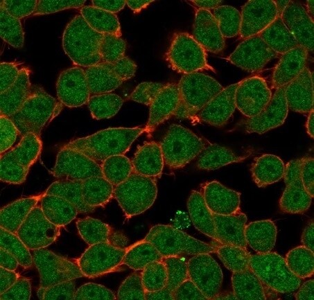 ZNF81 Antibody (PCRP-ZNF81-2G2) - Azide and BSA Free Immunocytochemistry/ Immunofluorescence: ZNF81 Antibody (PCRP-ZNF81-2G2) - Azide and BSA Free [NBP3-14088] -