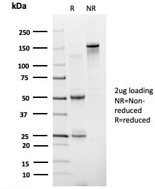 ZNF81 Antibody (PCRP-ZNF81-2G2) - Azide and BSA Free Immunocytochemistry/ Immunofluorescence: ZNF81 Antibody (PCRP-ZNF81-2G2) - Azide and BSA Free [NBP3-14088] -