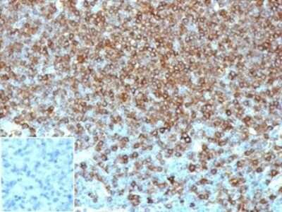 HLA DQ/DR/DP Antibody (HLA-Pan/6663) - Azide and BSA Free Immunohistochemistry-Paraffin: HLA DQ/DR/DP Antibody (HLA-Pan/6663) - Azide and BSA Free [NBP3-14091] -