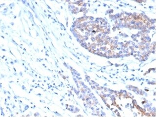 IGF-I R/IGF1R Antibody (IGF1R/4667) - Azide and BSA Free Immunohistochemistry-Paraffin: IGF-I R/IGF1R Antibody (IGF1R/4667) - Azide and BSA Free [NBP3-14094] -