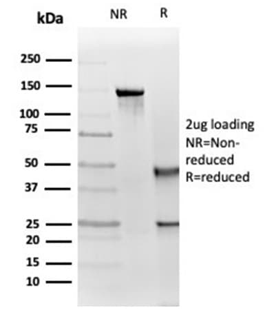 IGF-I R/IGF1R Antibody (IGF1R/4667) - Azide and BSA Free Immunohistochemistry-Paraffin: IGF-I R/IGF1R Antibody (IGF1R/4667) - Azide and BSA Free [NBP3-14094] -