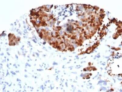 INSM1 Antibody (INSM1/6286R) - Azide and BSA Free Immunohistochemistry-Paraffin: INSM1 Antibody (INSM1/6286R) - Azide and BSA Free [NBP3-14105] -
