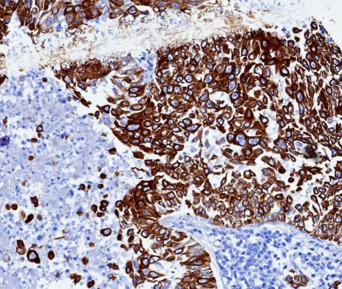 Cytokeratin 6a Antibody (KRT6/3997R) - Azide and BSA Free