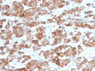 LH beta Antibody (LHb/1612R) - Azide and BSA Free Immunohistochemistry-Paraffin: LH beta Antibody (LHb/1612R) - Azide and BSA Free [NBP3-14112] -