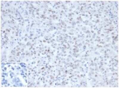 MLH1 Antibody (MLH1/6467) - Azide and BSA Free Immunohistochemistry-Paraffin: MLH1 Antibody (MLH1/6467) - Azide and BSA Free [NBP3-14122] -