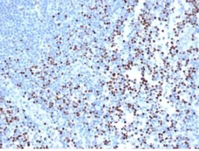 LEF1 Antibody (rLEF1/6906) - Azide and BSA Free Immunohistochemistry-Paraffin: LEF1 Antibody (rLEF1/6906) - Azide and BSA Free [NBP3-14130] -